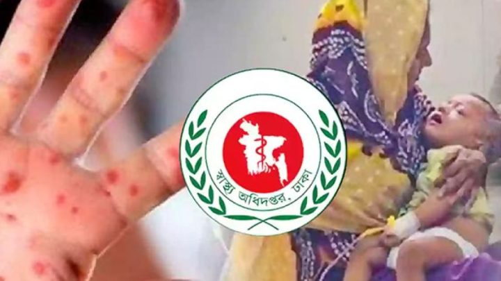 হামের থাবায় আরও ৫ শিশুর প্রাণহানি, নতুন আক্রান্ত প্রায় দেড় হাজার | সংবাদ